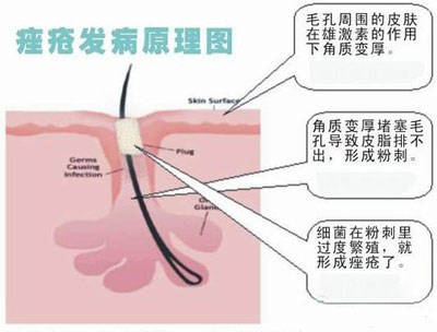 病理图